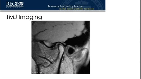 Thumbnail for TMD Imaging Supplement 2022 - Google Slides