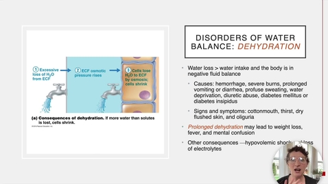 Thumbnail for Ch 26 III - Disorders of Water Balance