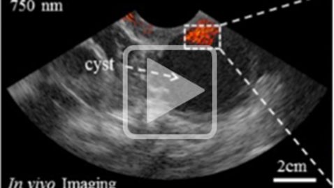 Thumbnail for entry Biomedical Optical Imaging and Machine Learning for Cancer and Disease Detection