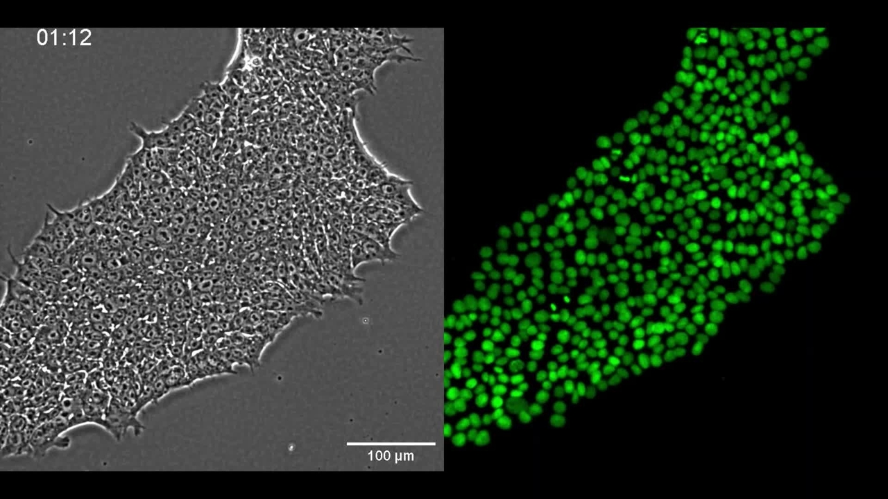 Phase Contrast and Fluorescence Images of an iPSC Colony in Time