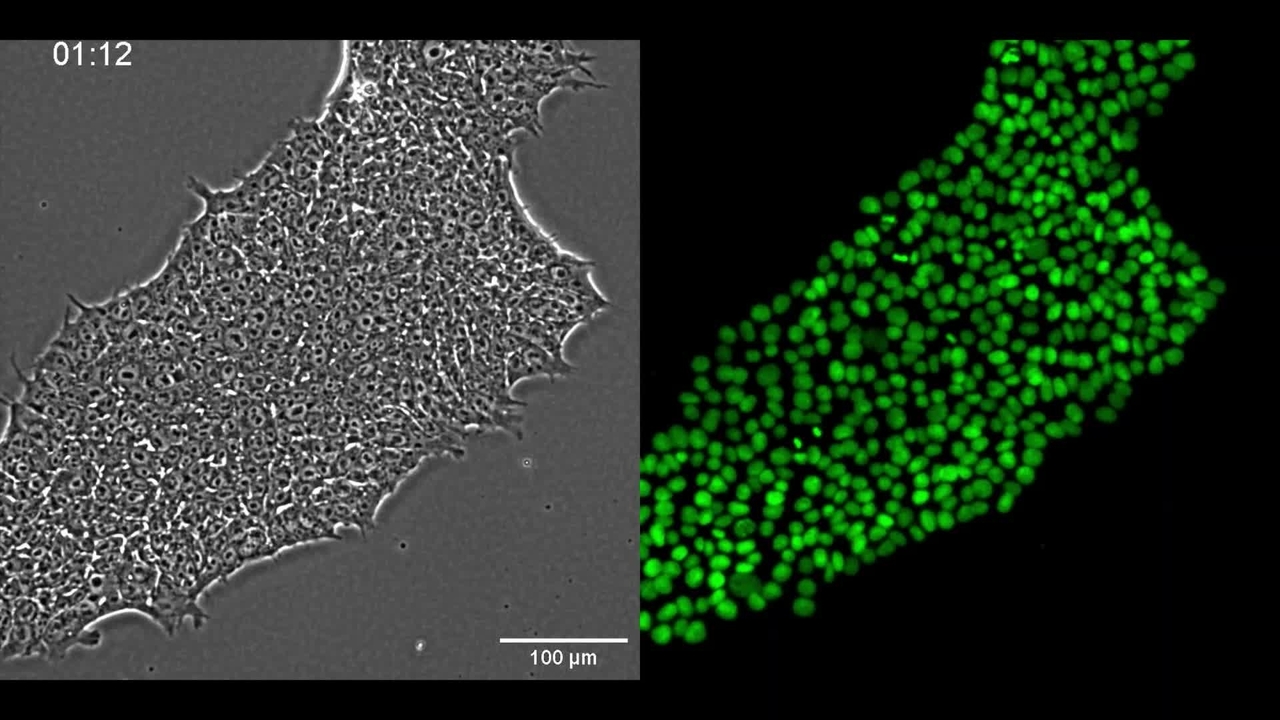 Phase Contrast and Fluorescence Images of an iPSC Colony in Time