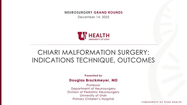 Grand Rounds: Douglas Brockmeyer, MD