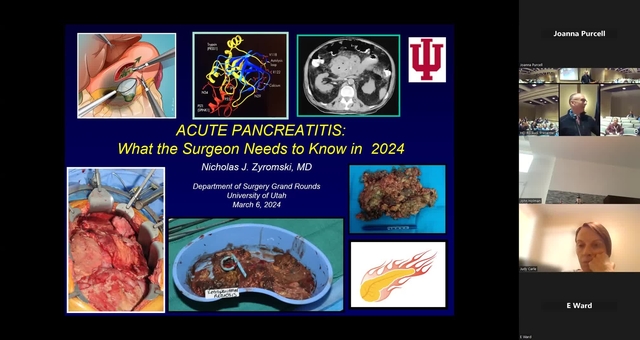 Grand Rounds: Nicholas Zyromski, MD