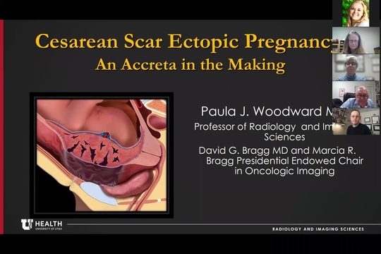 Grand Rounds: Paula J. Woodward, MD 