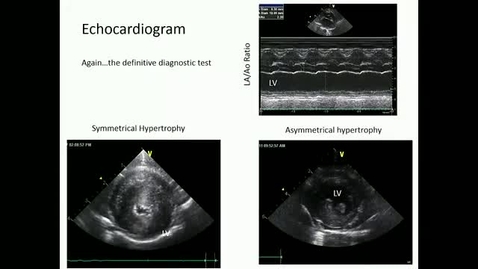 Thumbnail for entry VM 565-Echocardiogram (oldEcho360_Lect23)