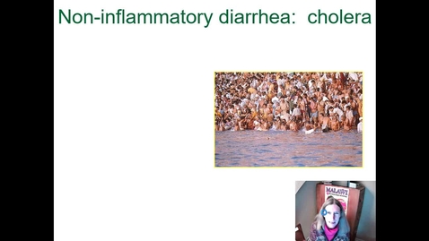 Thumbnail for entry IM618 - Diarrhea 2: Non-Inflammatory Diarrheas