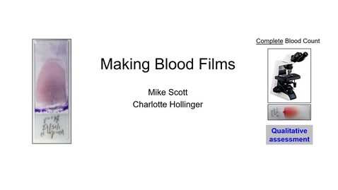 Thumbnail for entry VM 523-Making blood smears