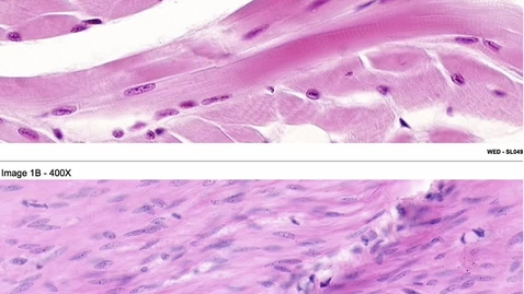 Thumbnail for entry Q12 Skeletal vrs Smooth Muscle
