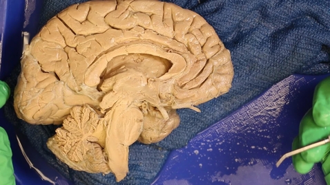 Thumbnail for OST571 (Lab 1.1) Overview &amp; Brain 