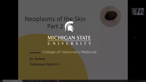 Thumbnail for entry VM 534-Neoplasms of the skin-part 2-Noland