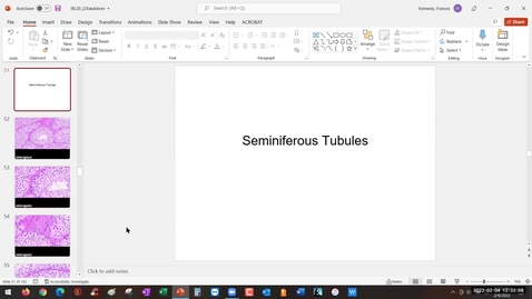 Thumbnail for entry Seminiferous Tubules Ductus Deferens Penis Sildenafil