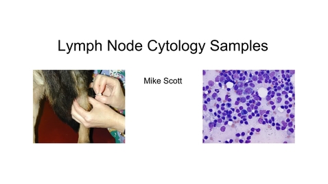 Thumbnail for entry VM 523-Lymph node sampling