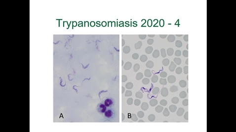 Thumbnail for entry IM618 - Trypanosomiasis 4: Immune Evasion, Control and Prevention