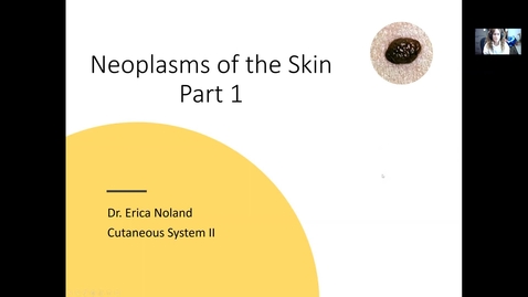 Thumbnail for entry VM 534-Neoplasms of the skin-Part 1-Noland