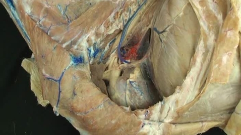 Thumbnail for entry VM 518-Left side of thorax structures visible after removal of lungs