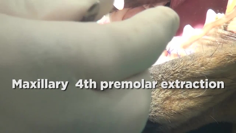 Thumbnail for entry Maxillary 4th premolar extraction