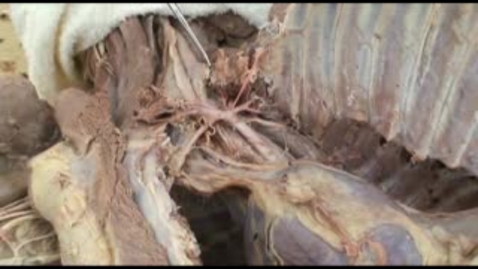 Thumbnail for entry VM 518-Thoracic nerves and vessels (2)