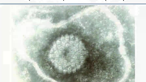 Thumbnail for entry VM 535-Equine Herpesviruses (EHV)