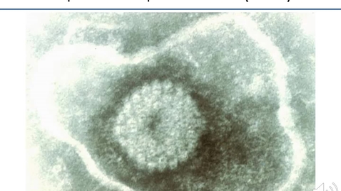 Thumbnail for entry VM 535-Equine Herpesviruses (EHV) 2021-Hussey