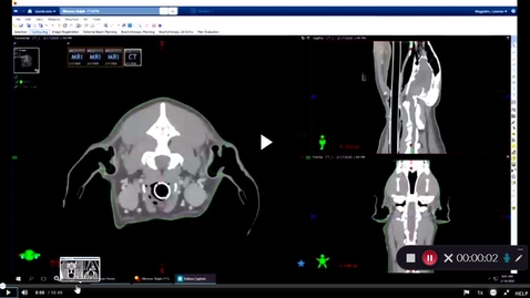Thumbnail for entry VM 571-Accelerated radiation treatment planning- canine brain tumor