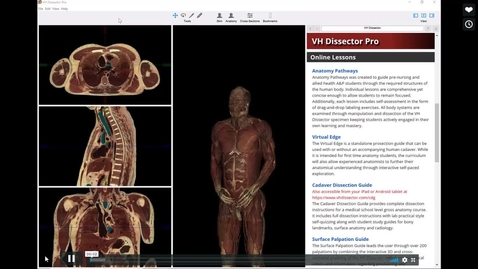 Thumbnail for entry VH Dissector User Instructions