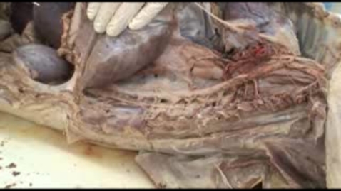Thumbnail for entry VM 517-Sympathetic innervation of the abdomen