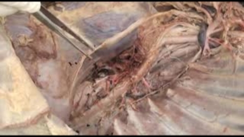 Thumbnail for entry VM 523-Lymphatic structures of thorax. Dissection video