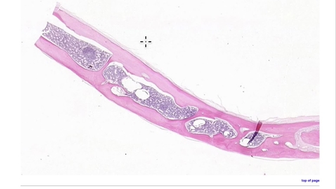 Thumbnail for entry 07-02 Bone Marrow - Location of Hematopoiesis