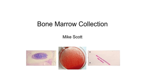 Thumbnail for entry VM 523-Collecting Bone Marrow