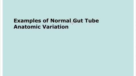 Thumbnail for entry 6-2 Gut Tube Normal Anatomic Variation