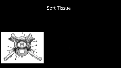 Thumbnail for entry VM 571-Vertebral Neuroimaging-Introduction to Cross-sectional Imaging and Neuroimaging