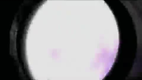 Thumbnail for Bad_sugar