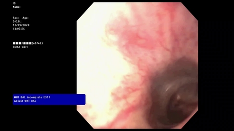 Thumbnail for entry VM 568-Cystoscopic Exam-PACS (no audio)