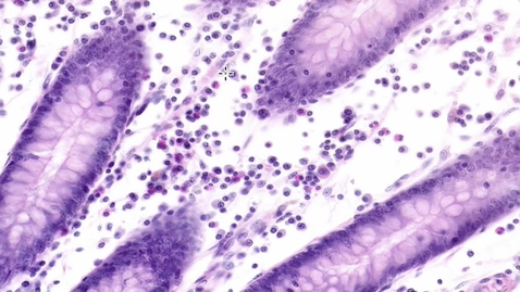 Thumbnail for entry Q4 Lamina Propria Small Intestine Plasma Cells