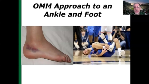 Thumbnail for entry Ankle and Foot Dx and TX