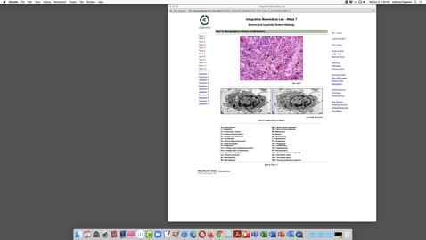 Thumbnail for entry 07-11 Macrophages in Spleen