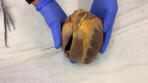 Thumbnail for entry VM 518-Interior of the heart 1-right atrium and ventricle-Dissection