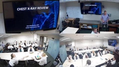 Thumbnail for AY 23-24 MCE Week 2 CXR Presentation