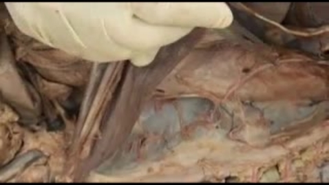 Thumbnail for entry VM 517-Dorsal vagal trunk and celiac branch