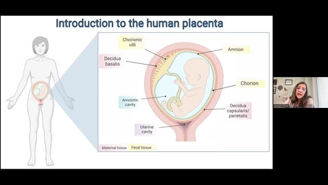 Thumbnail for entry PDI Seminar 2.23.23 - Defining the evolution of placental innate  immune defenses using organoids