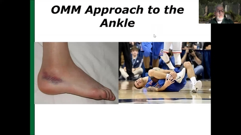Thumbnail for entry Ankle Dx and TX
