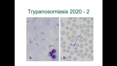 Thumbnail for entry IM618 - Trypanosomiasis 2: Clinical Presentation and Diagnosis