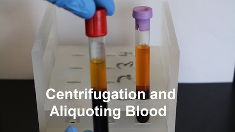 Thumbnail for entry VM 527-Centrifugation and Aliquoting of Blood Serum and Plasma