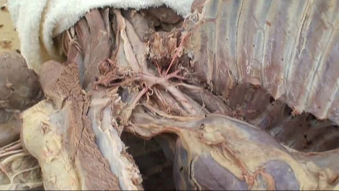 Thumbnail for entry VM 517 VM 520 Middle cervical ganglion, ansa subclavia, vertebral nerve, left and right recurrent laryngeal nerves