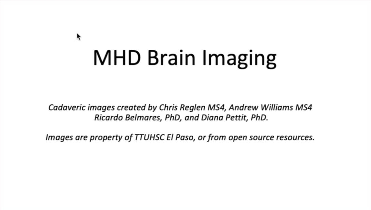 MHD Brain Imaging