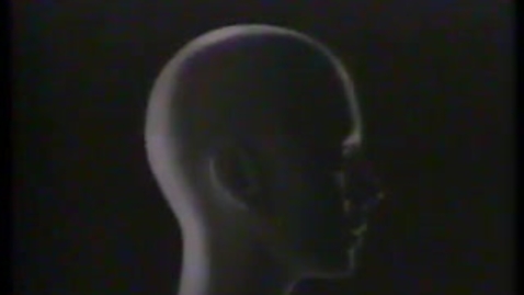 Thumbnail for PSY 120 Schizophrenia